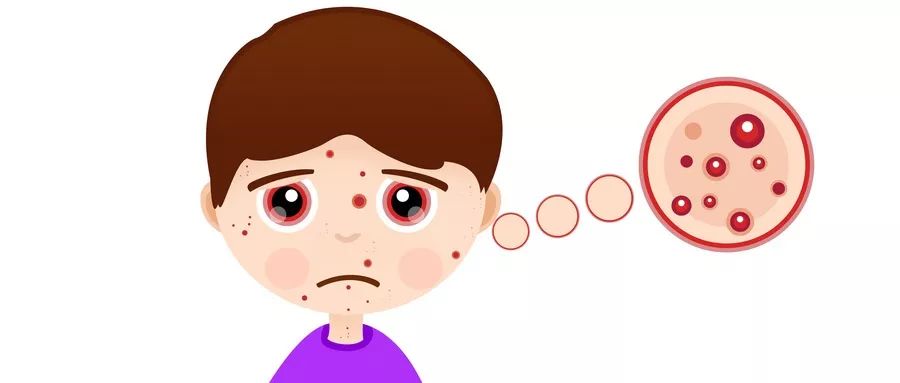 hpv扁平疣补硒（硒片对扁平疣有用处吗）-硒宝网