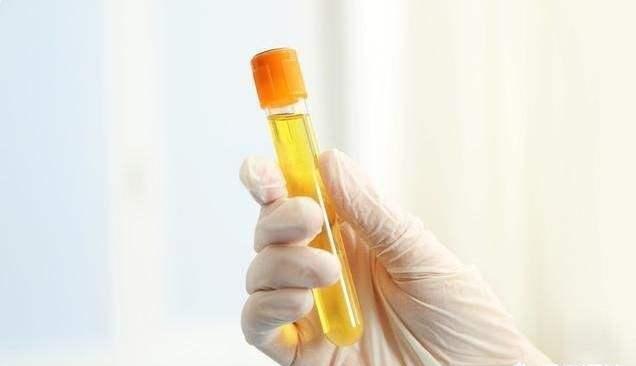 高尿酸能吃补硒吗(能补尿酸吃高硒酵母吗)-硒宝网