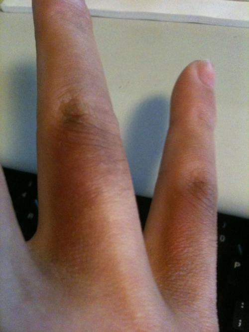 补硒皮肤会变黑吗(补变皮肤黑硒会变黑吗)-硒宝网