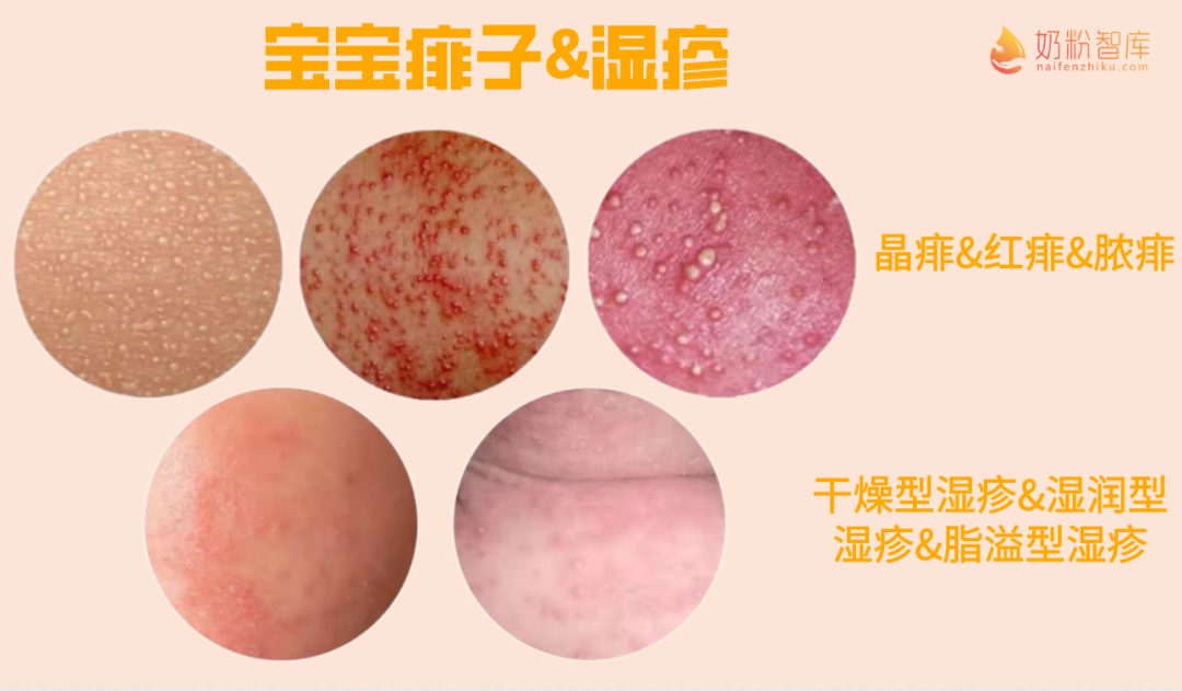 硒补多了会起疹子(补硒会引起皮肤过敏吗)-硒宝网