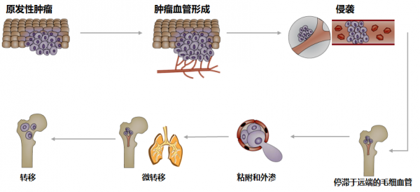补硒能治愈肺癌吗(肺癌补硒管用吗)-硒宝网