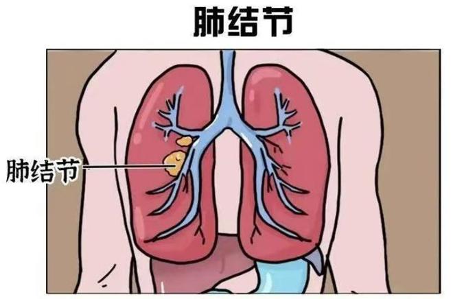 乳房实性结节补硒(乳腺实性结节钙化是什么意思)-硒宝网