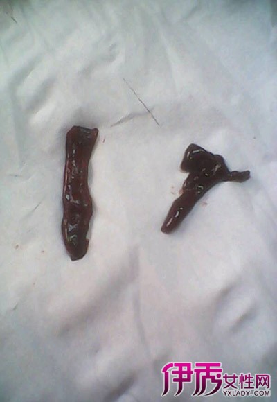 补硒月经会鲜红吗(月经鲜红补硒会变黑吗)-硒宝网