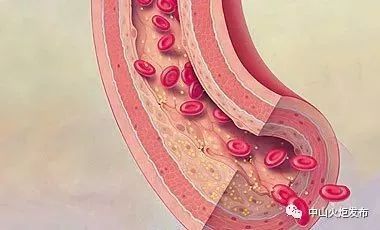 感冒了可以补硒吗(感冒补硒可以长期吃吗)-硒宝网
