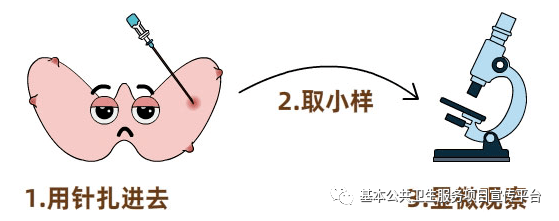 补硒突然甲状腺肿（甲状腺肿补碘能缩小吗）-硒宝网