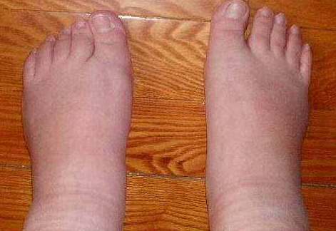 抽烟人可以补硒吗(硒对抽烟的作用)-硒宝网