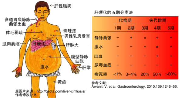 肝病为什么要补硒（补硒治愈了我的肝?。?硒宝网