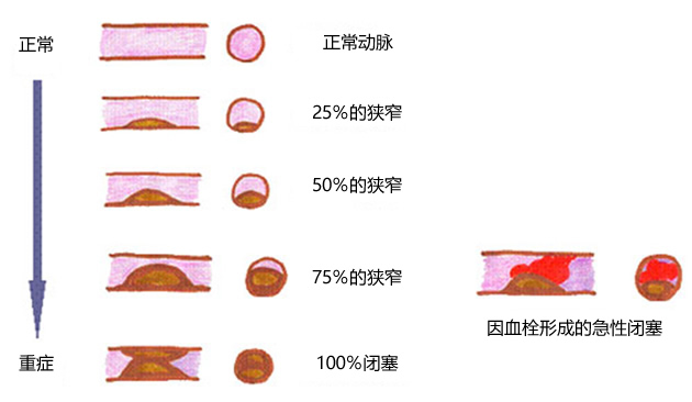 为什么老年要补硒(老年人补硒的重要性)-硒宝网