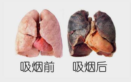 脑肿瘤需要补硒吗(在肿瘤治疗中补充硒元素)-硒宝网