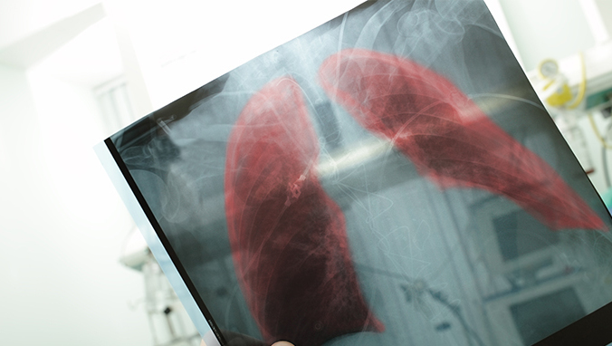 补硒改善肠胃的药(硒肠胃)-硒宝网