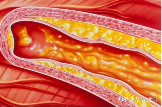 为什么心脏要补硒（硒对心脏哪个部位有着重要作用）-硒宝网