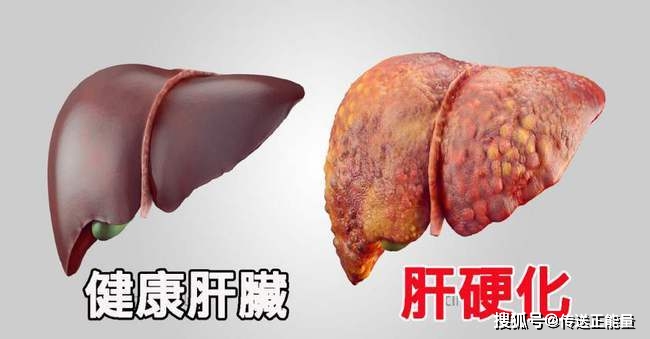 乙肝患者怎么补硒(补患者乙肝硒片吃多久)-硒宝网