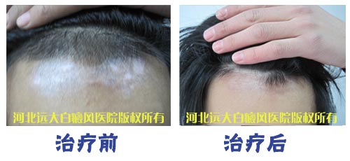 医院有补硒的药品(药品补医院硒有什么好处)-硒宝网