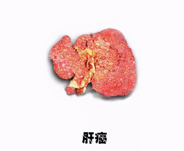 补硒对睡眠有帮助(补硒睡眠好)-硒宝网