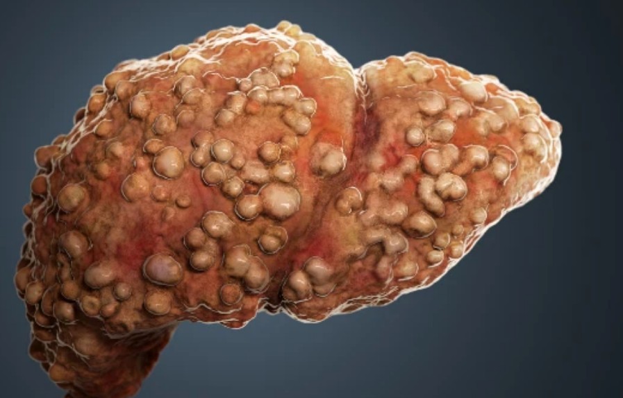 补硒对睡眠有帮助(补硒睡眠好)-硒宝网