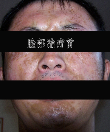 补硒多久变白皮肤(硒皮肤)-硒宝网