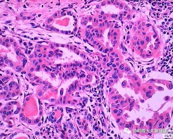 桥本甲减补硒推荐（桥本补充硒）-硒宝网