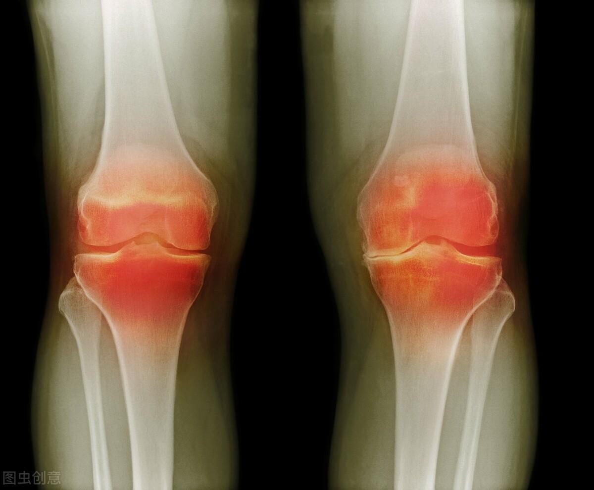 类风湿因子高补硒（风湿因子高吃点什么饮食能下降）-硒宝网