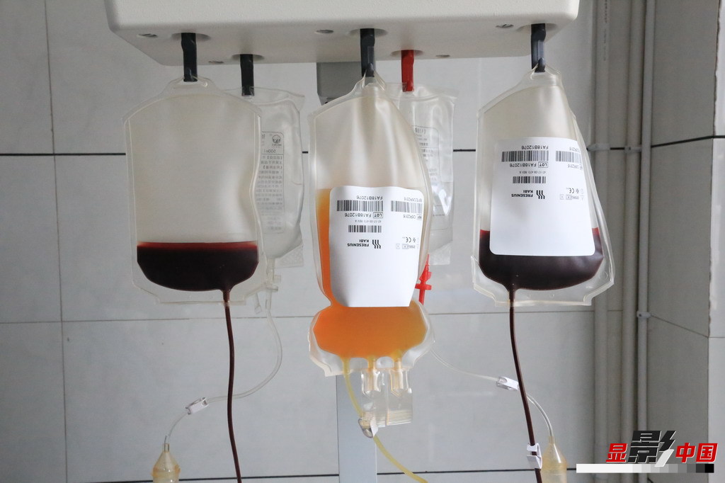 血小板减少症补硒(血小板低可以补硒吗)-硒宝网