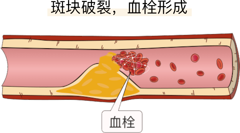 补硒的功效和坏处(硒对人体的好处和坏处)-硒宝网