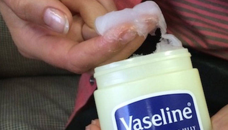 补硒会鼻子出血吗（鼻子出血需要补充什么维生素）-硒宝网