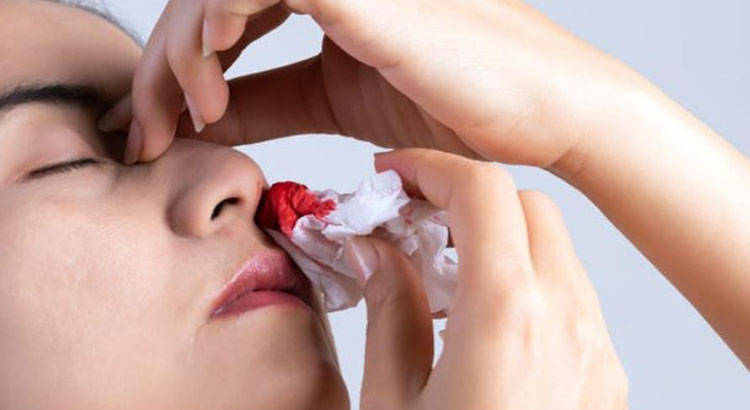 补硒会鼻子出血吗（鼻子出血需要补充什么维生素）-硒宝网