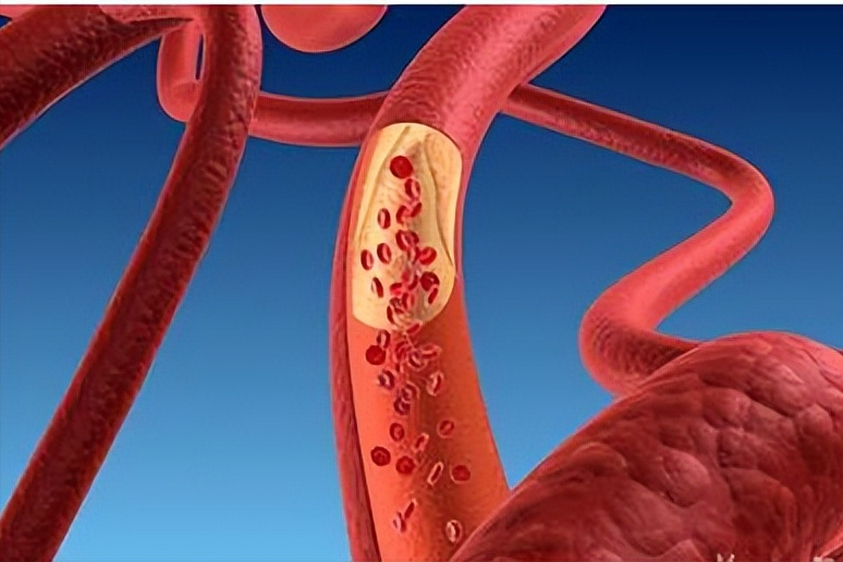 缺少硒吃啥补最好（缺少硒吃什么补）-硒宝网