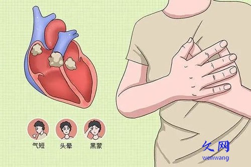补硒预防新冠病毒（新冠期间哪个教授建议补硒）-硒宝网