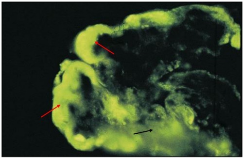 狼疮肾炎可补硒吗(硒对红斑狼疮的作用)-硒宝网