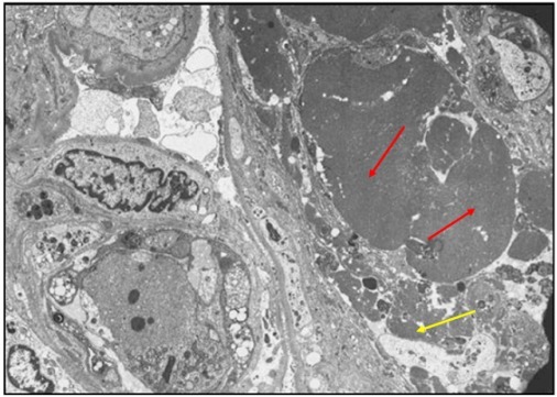 狼疮肾炎可补硒吗(硒对红斑狼疮的作用)-硒宝网