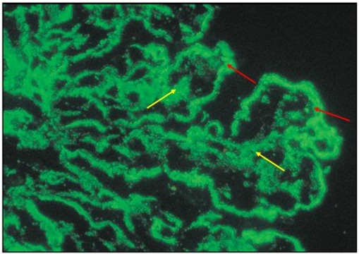 狼疮肾炎可补硒吗(硒对红斑狼疮的作用)-硒宝网