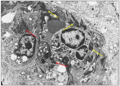 狼疮肾炎可补硒吗(硒对红斑狼疮的作用)-硒宝网