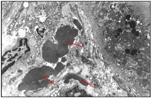 狼疮肾炎可补硒吗(硒对红斑狼疮的作用)-硒宝网