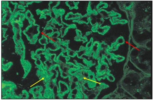 狼疮肾炎可补硒吗(硒对红斑狼疮的作用)-硒宝网