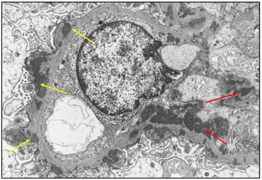 狼疮肾炎可补硒吗(硒对红斑狼疮的作用)-硒宝网