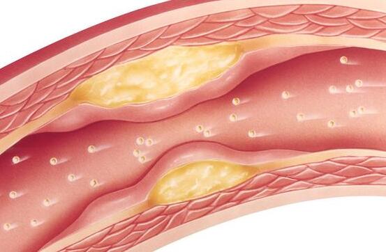 血粘稠可以补硒吗(补硒对贫血有什么作用)-硒宝网