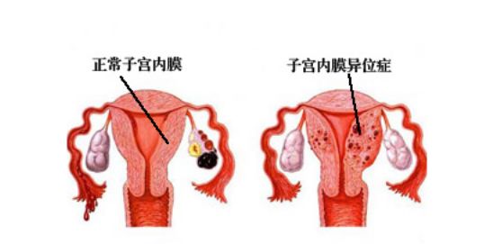 月经疼补硒好吗吗(经期补硒)-硒宝网