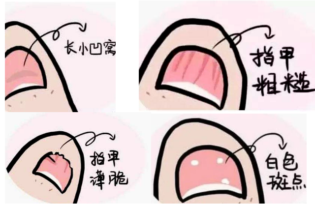 补硒 甲营养不良(甲营养不良补充什么维生素)-硒宝网