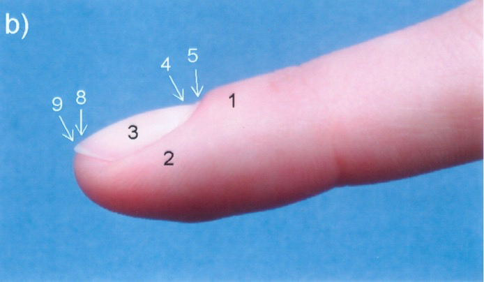 补硒 甲营养不良(甲营养不良补充什么)-硒宝网