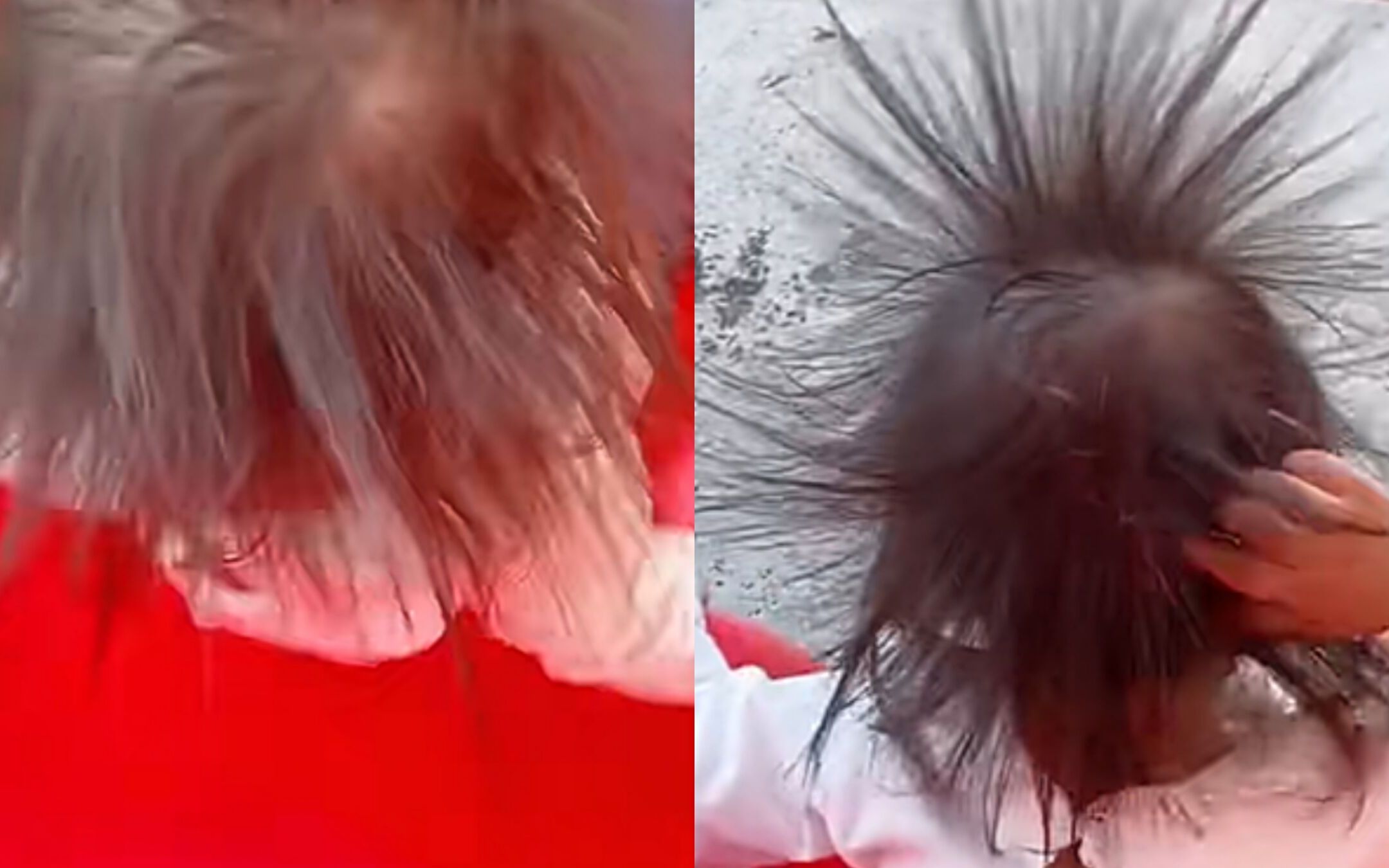 吃补硒胶囊脱头发(脱发补硒)-硒宝网