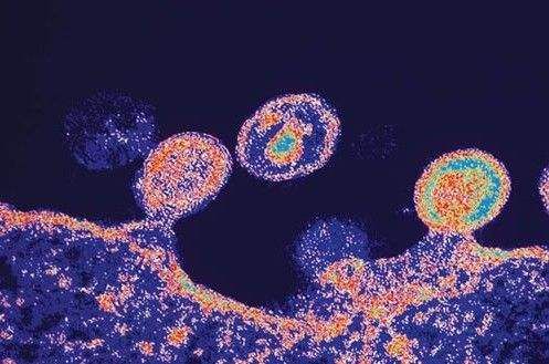 艾滋病人怎样补硒（病人补艾滋硒好吗）-硒宝网