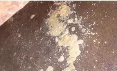 补硒能引起腹泻么(腹泻能补引起硒缺乏吗)-硒宝网