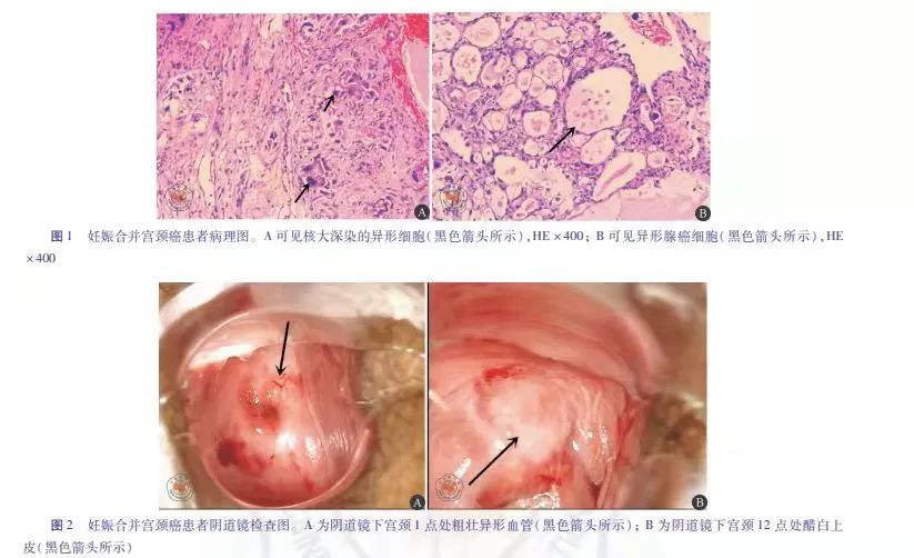 怀孕后可以补硒吗(怀孕吃硒没事吧)-硒宝网