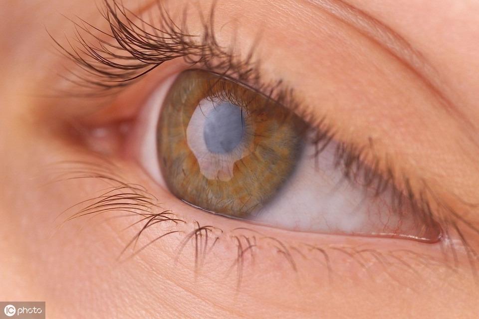 甲亢眼突可以补硒（甲亢病人可以补硒吗）-硒宝网