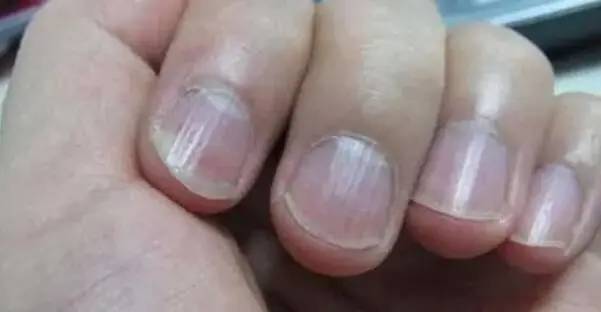 肝脏不好要补硒吗（补硒对肝病患者有好处吗）-硒宝网