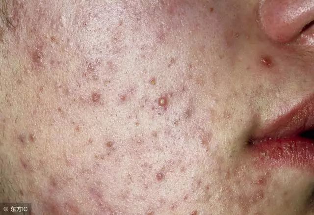 肝脏不好要补硒吗(补硒对肝脏的好处吗)-硒宝网