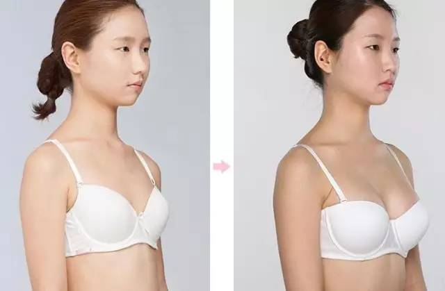 补硒能治疗皮炎吗（硒皮肤?。?硒宝网