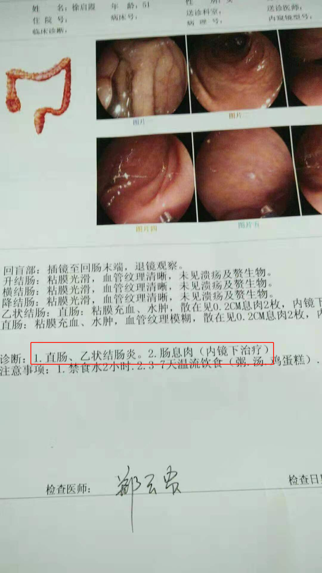 补硒对肠息肉好处(补硒能治疗肠息肉)-硒宝网