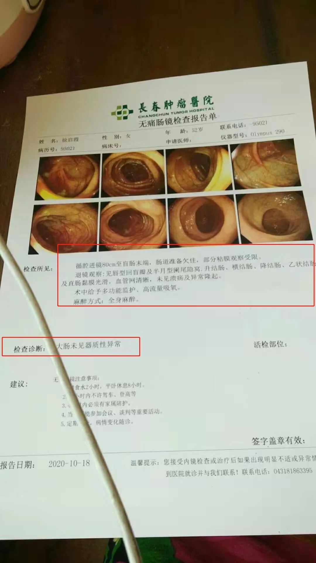 补硒对肠息肉好处(补硒能治疗肠息肉)-硒宝网