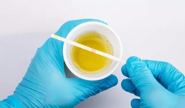 补硒大便颜色变深(大便补颜色变硒怎么回事)-硒宝网